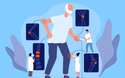 Osteoporosis in Seniors: Preventing Bone Fractures and Managing Bone Health.