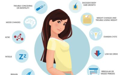Polycystic Ovary Syndrome (PCOS): Causes, Symptoms, and Treatment Options for Women